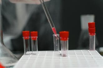 What Does a 10 Panel Drug Test Check For? A Simple Breakdown